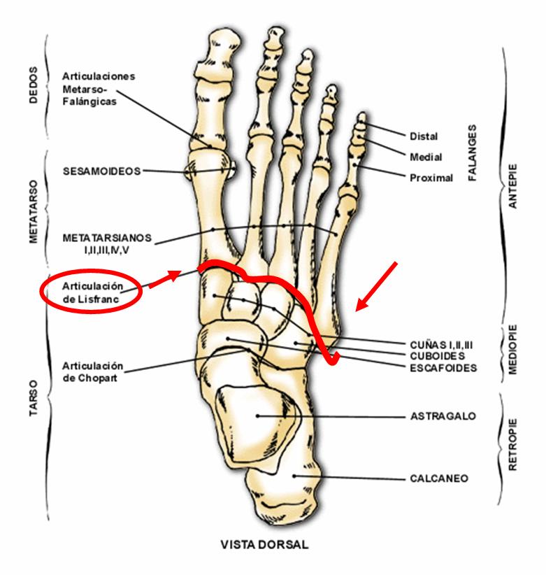 lisfranc